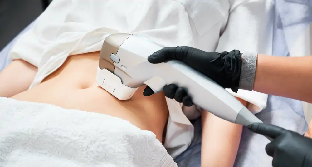 Laser Skin Resurfacing